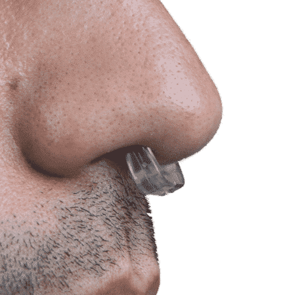 Sanaclip in der Nase